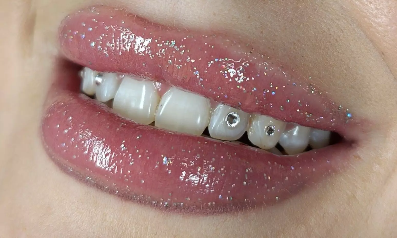 Biżuteria nazębna: kryształki w różnych wzorach i kolorach