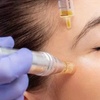 Image 1: Reveal Your Natural Glow PRP Facials & Hair Rejuvenation @ A+ Day Spa