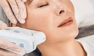 HIFU Facelift with Complementary Cryo Cooling Therapy (Up to 78% Off)