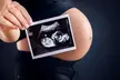 Experience First, Second, or Third Trimester Service For Gentle, Safe, and Soothing Care  (Up to 16% Off) - Second Medium
