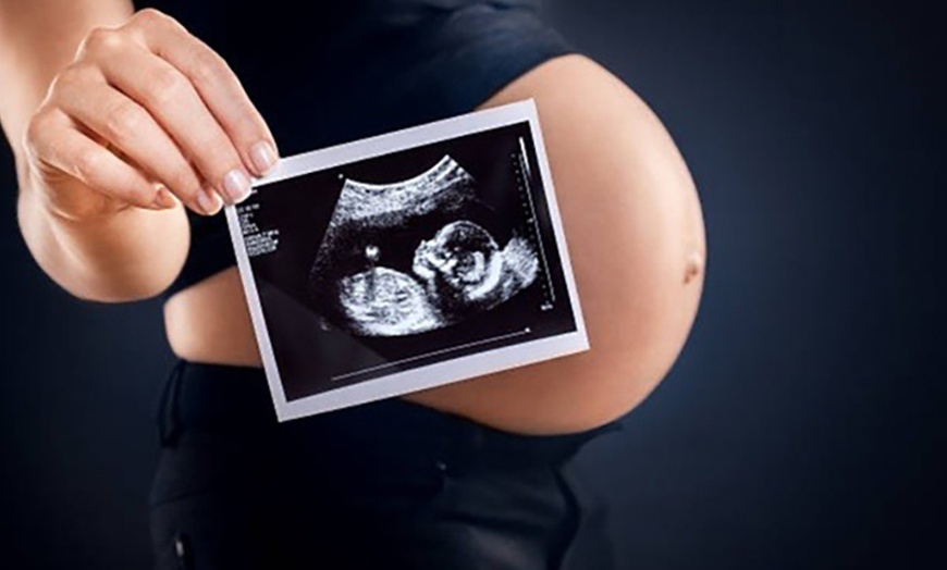 Image 5: Up to 37% Off on Ultrasound - 3D / 4D at Miracle Ultrasound And Spa Llc