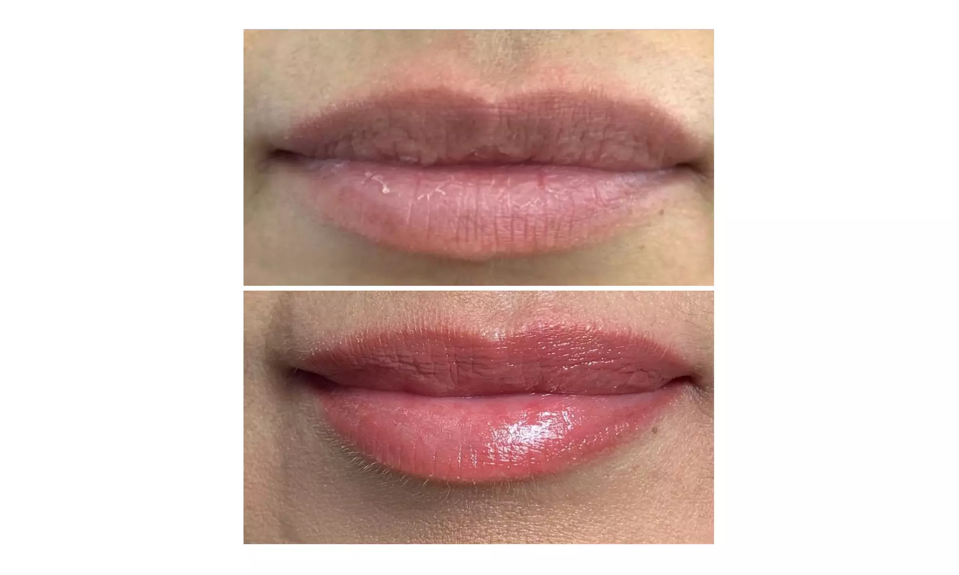  One Permanent Eyebrow, Eyeliner, Lip Blush or Saline Tattoo Removal