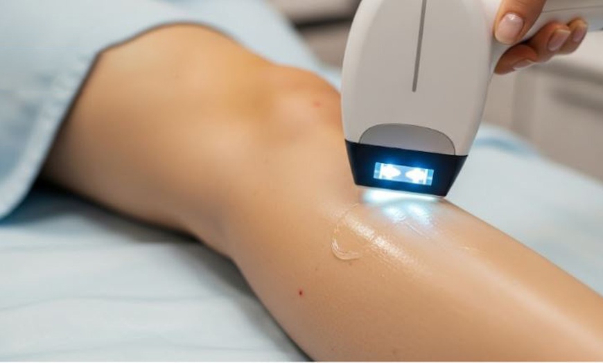 Image 1: One, Two or Three Sessions of IPL Hair Removal for Choice of Areas