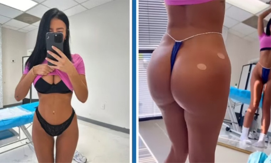 Image 7: 60 Minute Lymphatic Drainage Massage: 1 or 3 Sessions