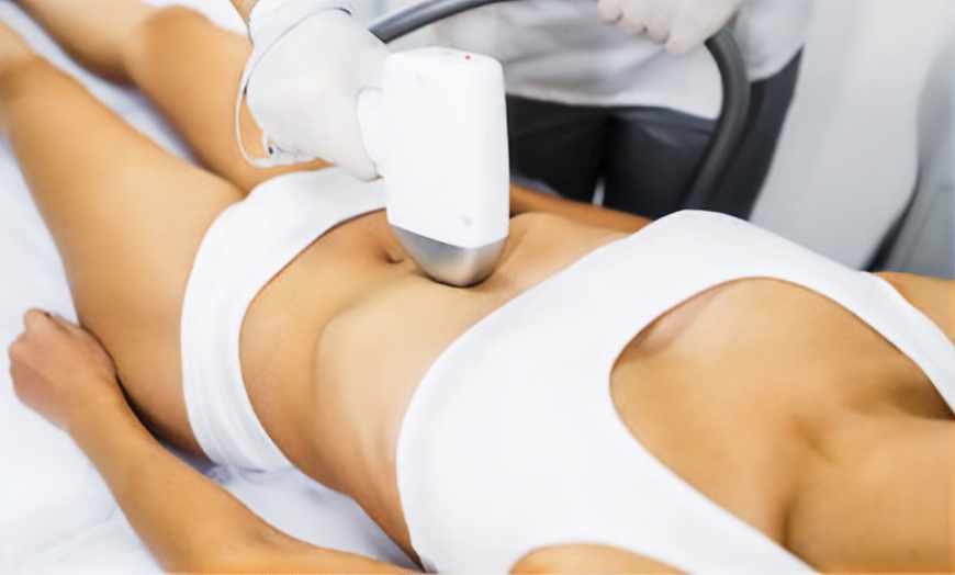 Image 9: Depilación con láser de diodo en zona a elegir para 1 persona