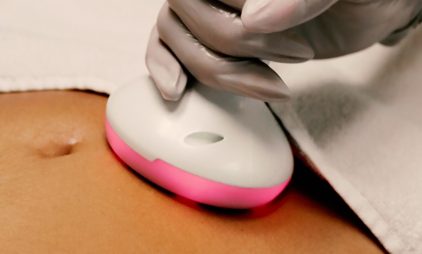 Image 2: Body Cavitation & Radio Frequency or LPG Endermologie Cavitation