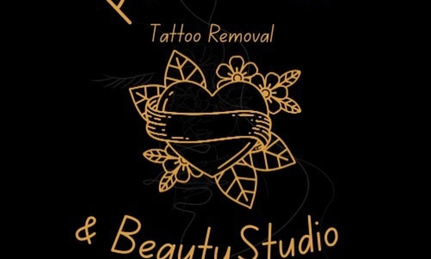 Image 3: Three or Six Laser Tattoo Removal Session w/ Consultation & Patch Test