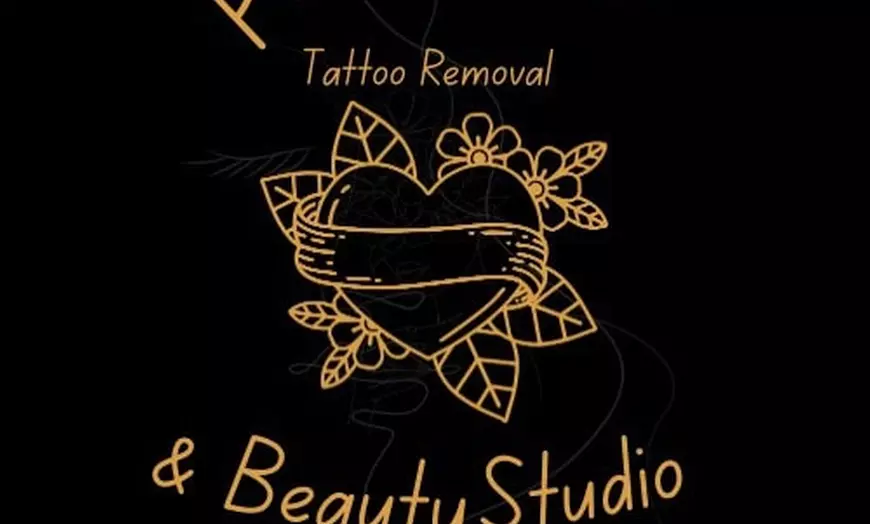 Image 3: Three or Six Laser Tattoo Removal Session w/ Consultation & Patch Test