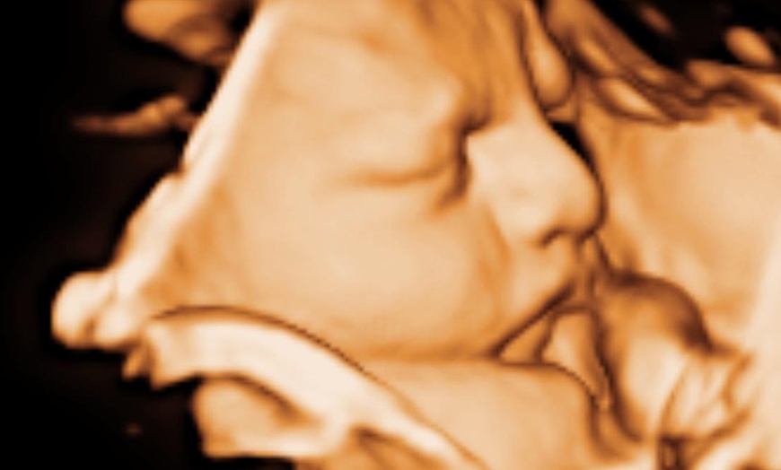 Image 2: Ecografía 4D-5D emocional básica o plus para conocer a tu bebé