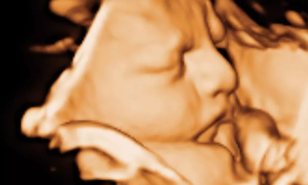 Tu bebé más cerca: ecografía 4D-5D emocional básica o plus