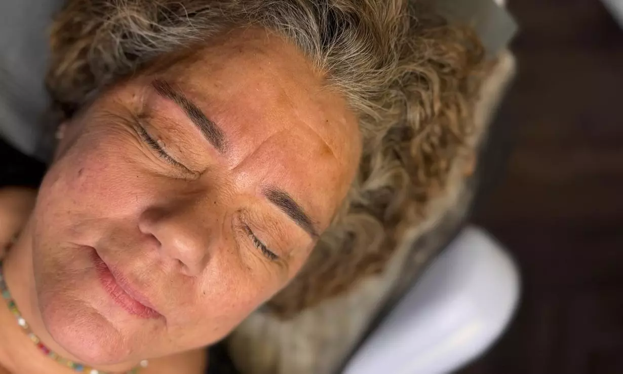 Stralende teint met huidverzorgende carbon laser behandeling