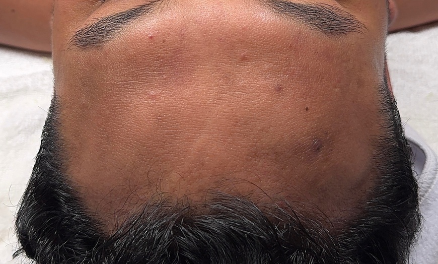 Image 3: Silk Lite Hydrodiamond Facial or Silk Deluxe Facial