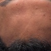 Image 3: Silk Lite Hydrodiamond Facial or Silk Deluxe Facial
