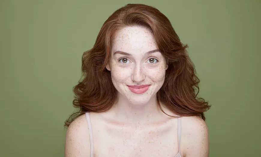 One IPL Photo Facial for a Youthful Radiance