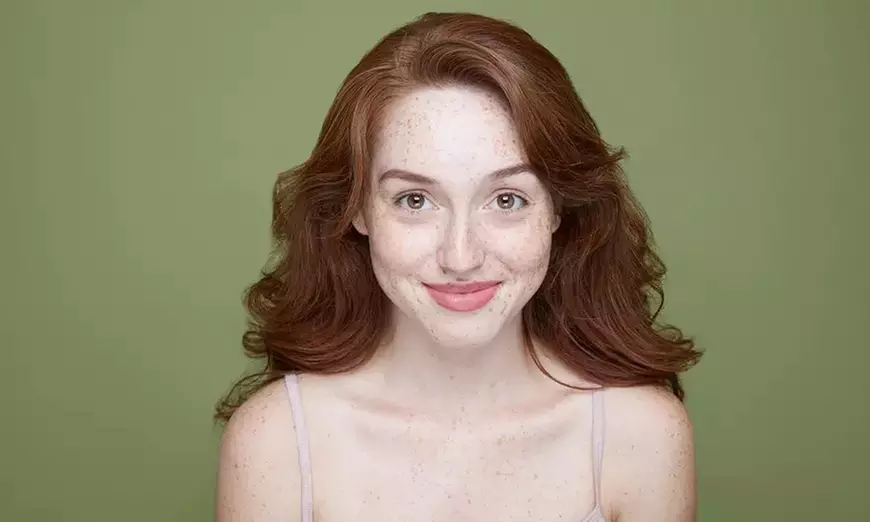Save 47% on One IPL Photo Facial at Liquivida Wellness Center for a Youthful Radiance! - Primary Image