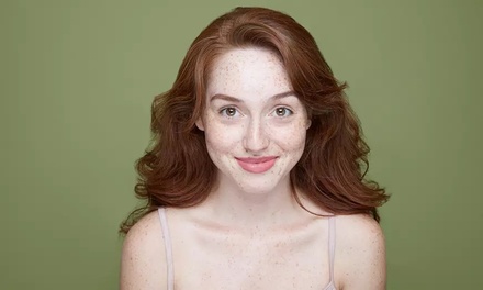 One IPL Photo Facial - Liquivida Wellness Center - Ridgewood