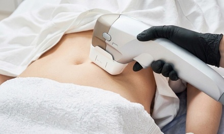 Hifu body+velashape full legs and glutes - Dermanova Spa And Salon
