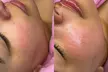 Pamper Yourself with 1-Hour 15-Minute Custom Facial or Eyebrow Shape and Tint ( Up to 37% Off ) - Second Medium