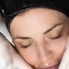 Image 3: Microdermabrasion + LED or Carbon Facial at NIZ (Up to 57%Off)