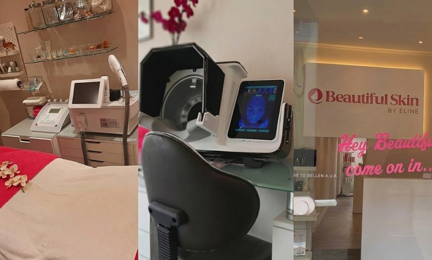 Image 3: Gezichtsbehandeling of huidverbetering naar keuze