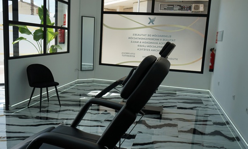 Image 2: Eliminación de manchas con Q-SWITCHED: 1 o 2 sesiones 