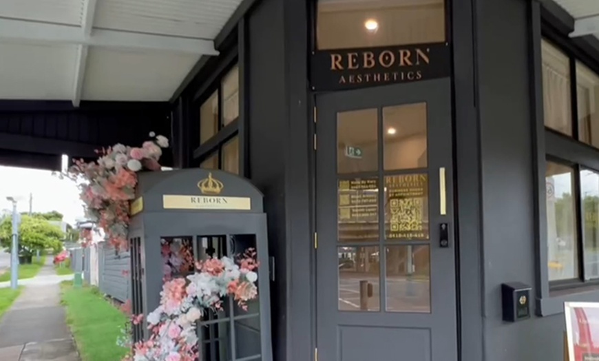 Image 5: Christmas Special: One Area Skin Needling with LED Therapy