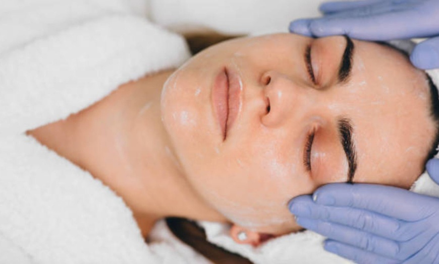 Image 14: Hollywood peeling con mascarilla de carbón activo y láser