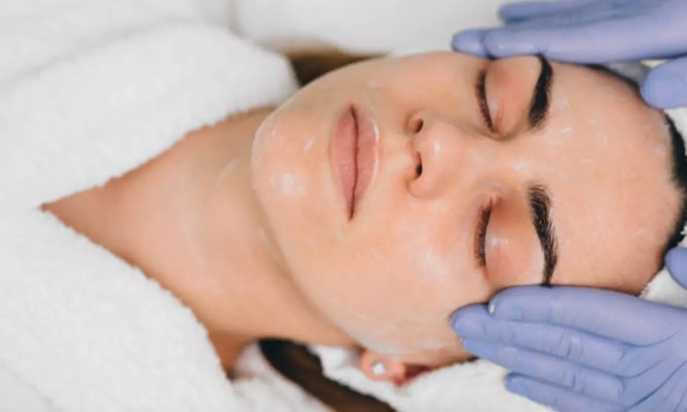 Hollywood peeling con mascarilla de carbón activo y láser