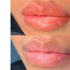 Image 3: Permanent Lip Blush & Microblading Brows