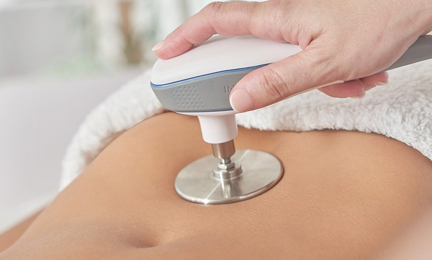 Image 5: 1, 2 o 4 sesiones de radiofrecuencia facial