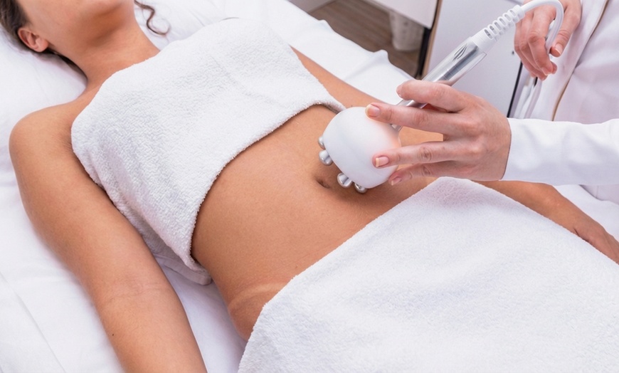 Image 3: 3 o 6 sesiones de tratamiento reductor anticelulítico en zona a elegir