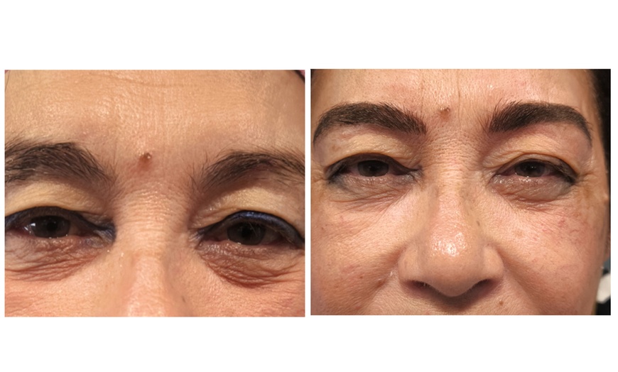 Image 3: Sesión de microblading de cejas pelo a pelo con opción a retoque 