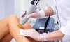 Six Laser Hair Removal Sessions on One Small/Medium/Large/X-Large Area at Modern Med Spa (Up to 73% Off)
