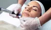 Enhance Your Look with One or Three PRP Facial or PRP Hair Restoration Injections (Up to 49% Off)