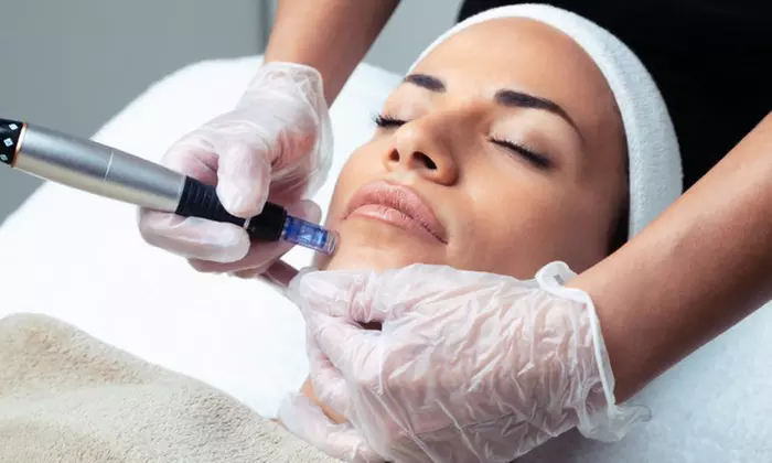 Enhance Your Look with One or Three PRP Facial or PRP Hair Restoration Injections (Up to 49% Off) - Primary Image