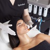 Image 2: Up to 71% Off on Micro-Needling at Aesthetics London Academy