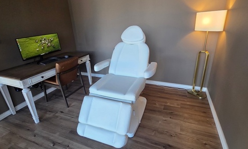 Image 2: Microneedling with PRF: One or Two 60-Minute Treatments