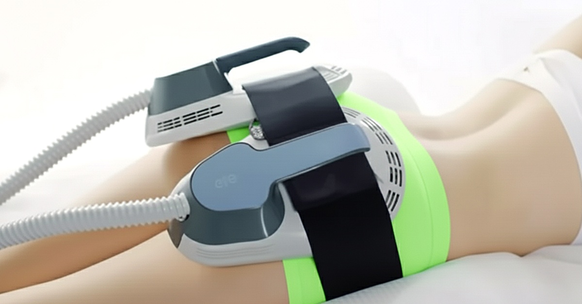 Tratamiento Body Sculpt con radiofrecuencia en Madrid