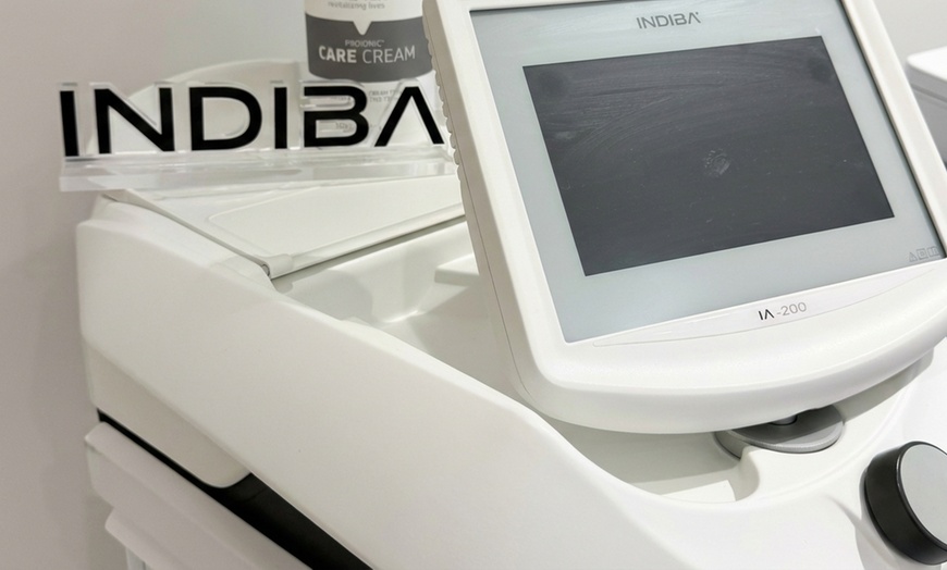 Image 3: 60-Minute Indiba Radio-Frequency Skin-Tightening Treatment