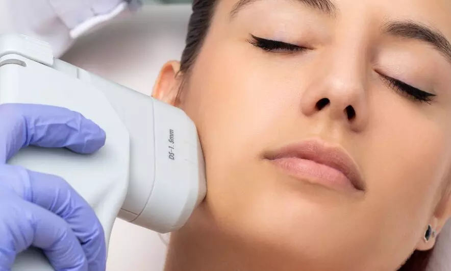 Tratamiento HIFU en zona a elegir con radiofrecuencia