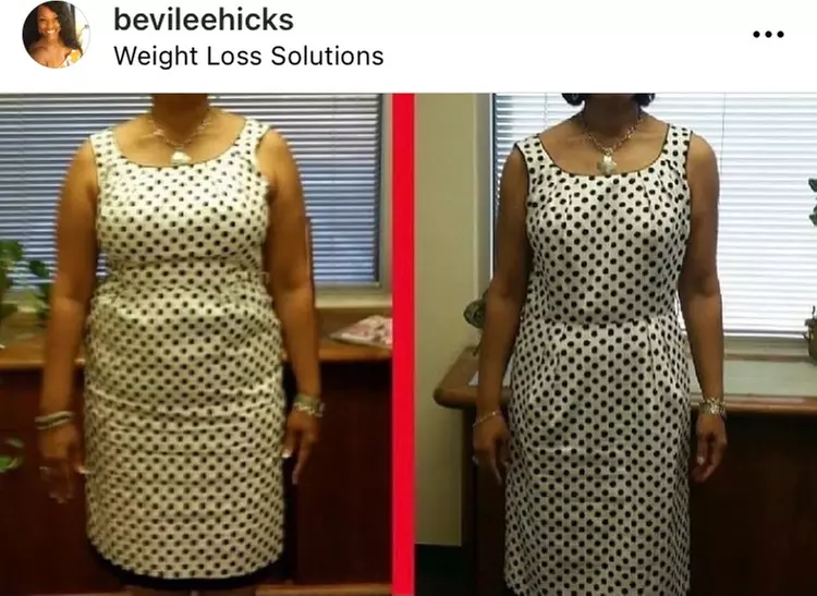 Sculpt Your Body: Laser Lipo Sessions