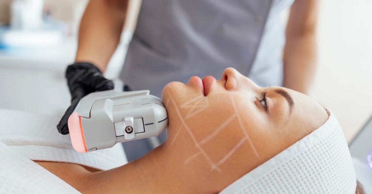Sesión de HIFU facial en Barcelona con opción a cuello o escote