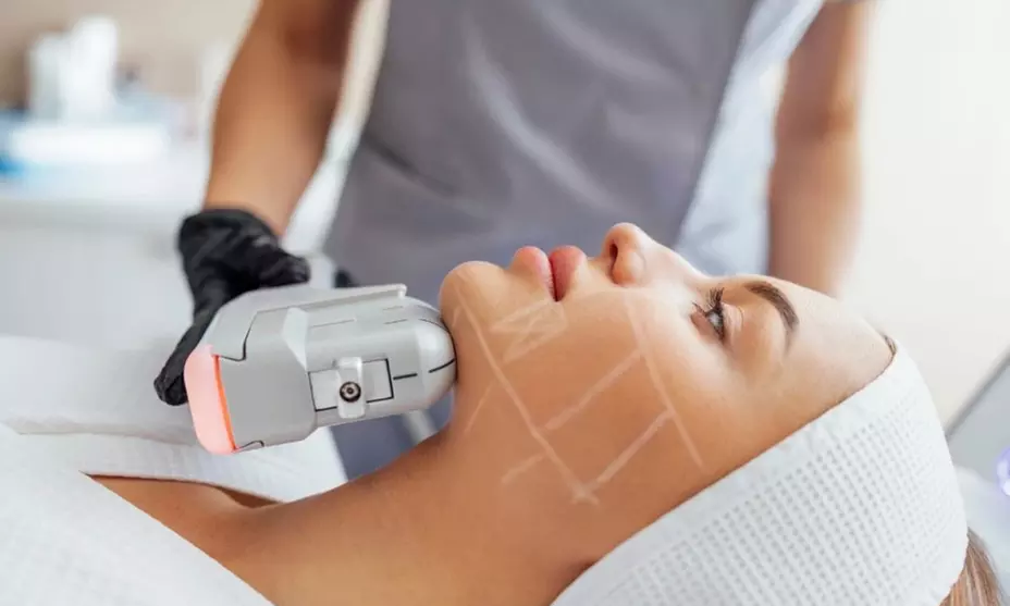 HIFU en rostro completo con opción a cuello o escote para 1