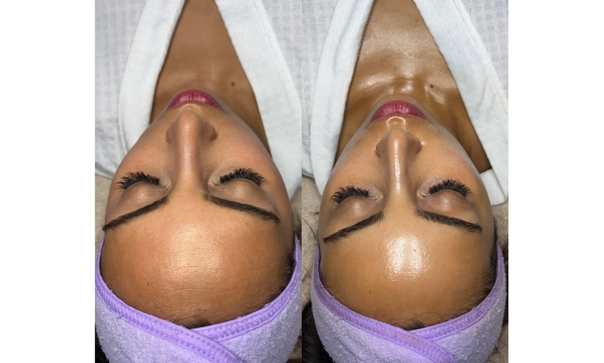 Image 3: 60-Minute 'Reset Series' Facial for Skin Balance & Clarity