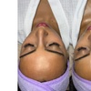 Image 3: 60-Minute 'Reset Series' Facial for Skin Balance & Clarity
