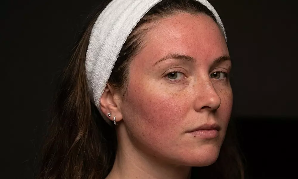 HydroFacial Treatments with Essential Glow Glass Skin & Reset Options