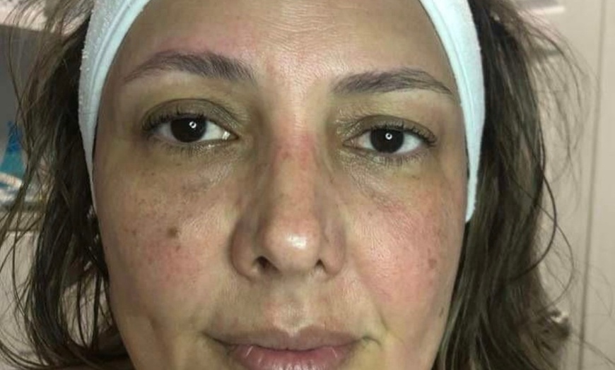 Image 3: Ultrasonic Cavitation and HIFU for Various Body Areas