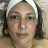 Image 3: Ultrasonic Cavitation and HIFU for Various Body Areas
