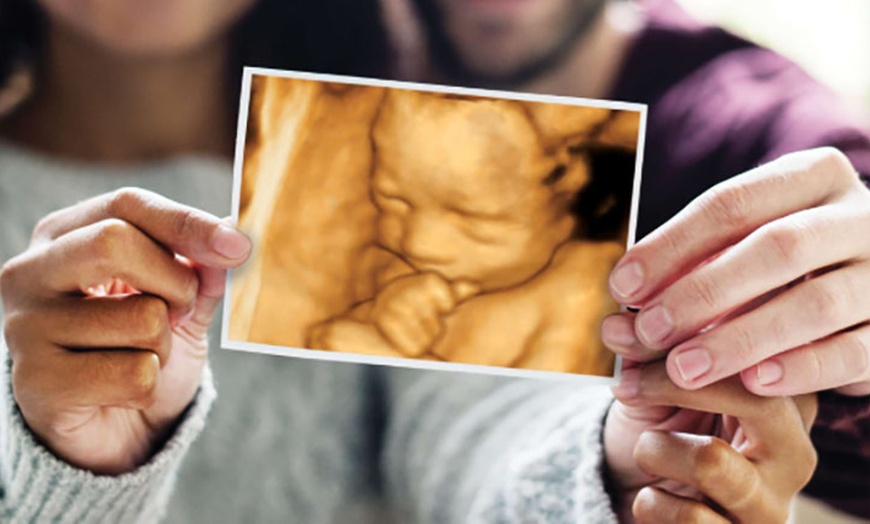 Image 2: Baby's Growth & Presentation or Wellbeing and 4D Baby Scan