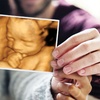 Image 2: Baby's Growth & Presentation or Wellbeing and 4D Baby Scan